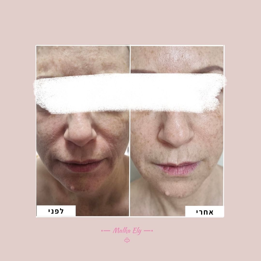 לפני אחרי אפריל